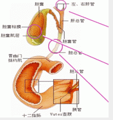 慢性胆囊炎